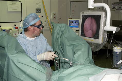 endoscopie de adenom de prostată